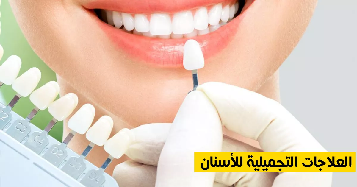 العلاجات التجميلية للأسنان